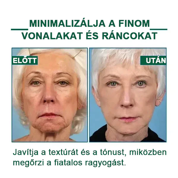 Florévia™ - Sérum Rejuvenescedor e Firmador