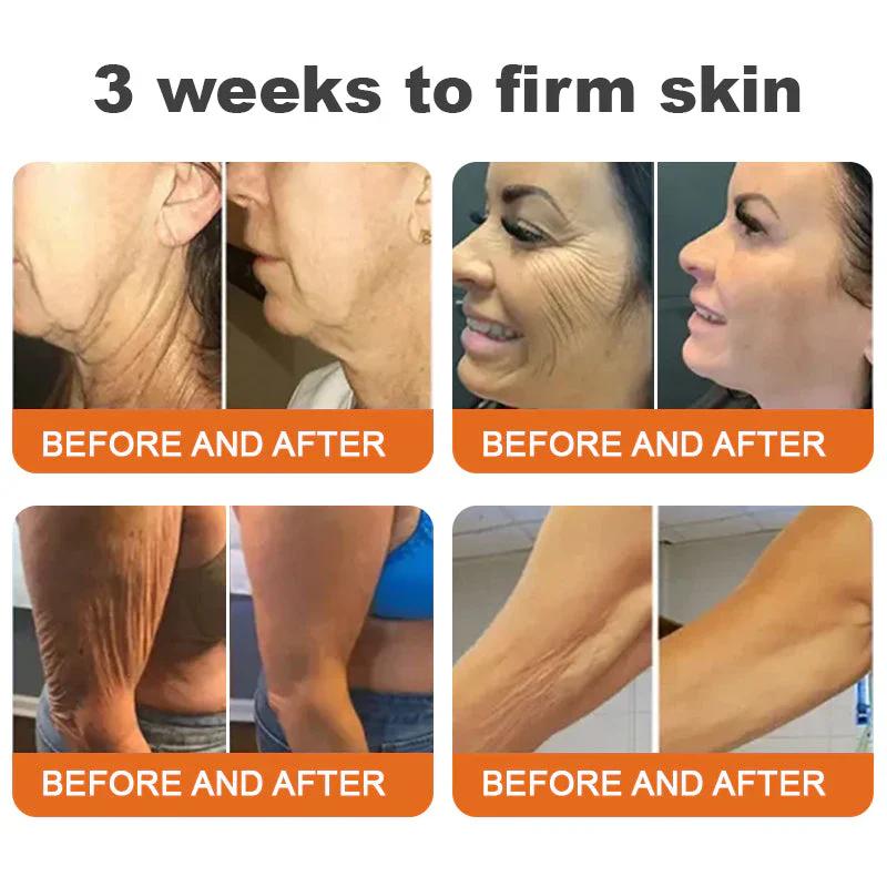 Bastão Botox Bee