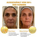 BotoxLux Restauração Facial