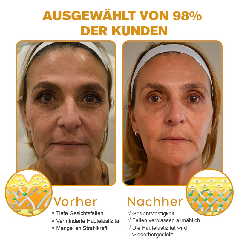 BotoxLux Restauração Facial
