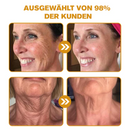 BotoxLux Restauração Facial