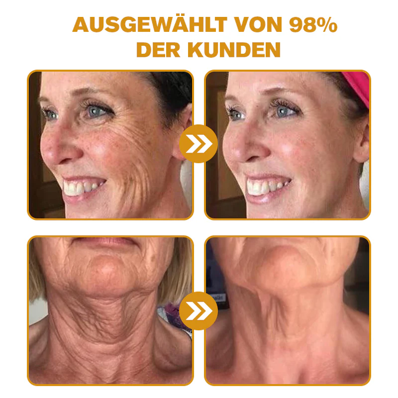 BotoxLux Restauração Facial