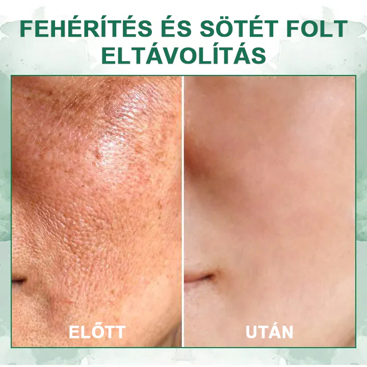 Florévia™ - Sérum Rejuvenescedor e Firmador