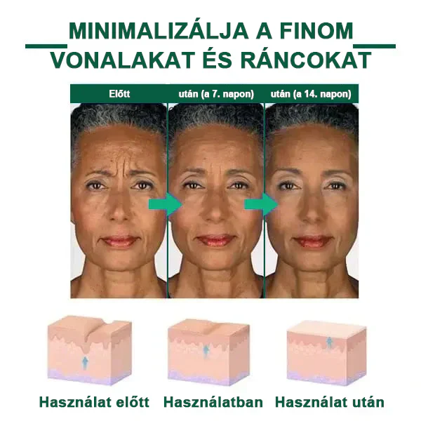 Florévia™ - Sérum Rejuvenescedor e Firmador