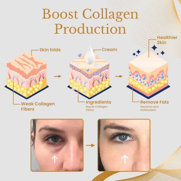 AgeErase Cream