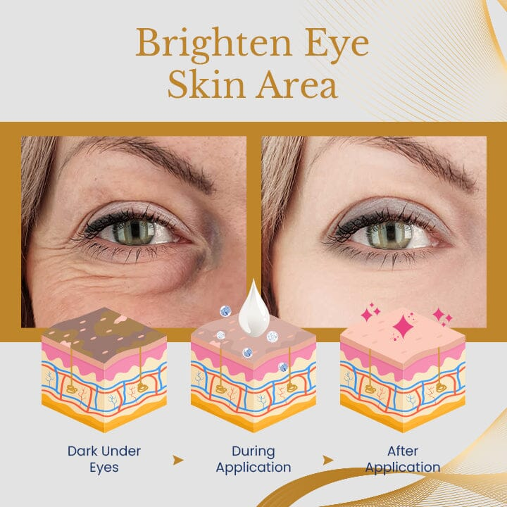 AgeErase Cream