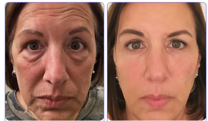 Veze Creme para os olhos