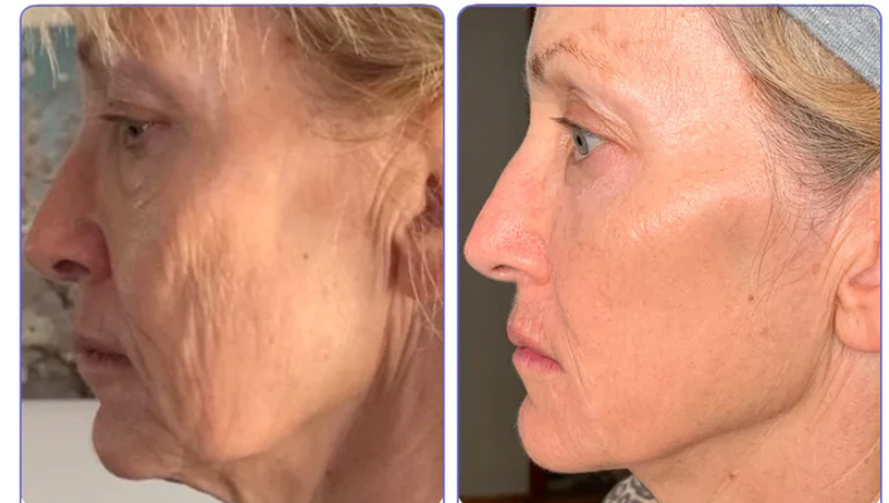 Veze Creme para os olhos
