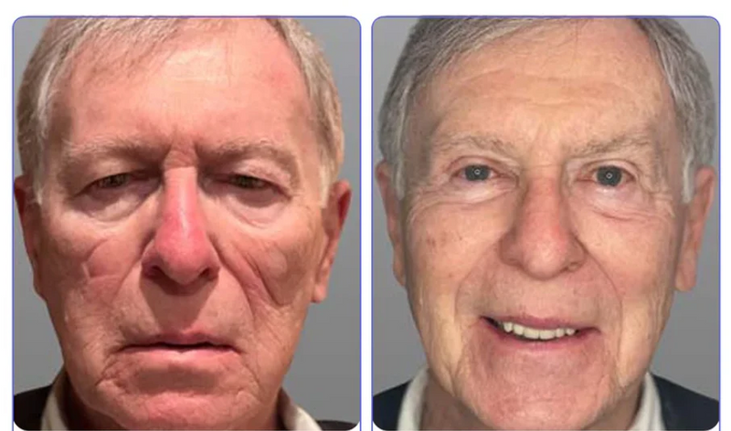 Veze Creme para os olhos