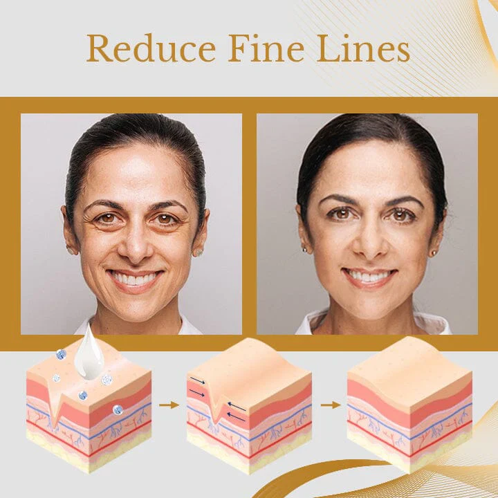 AgeErase Cream