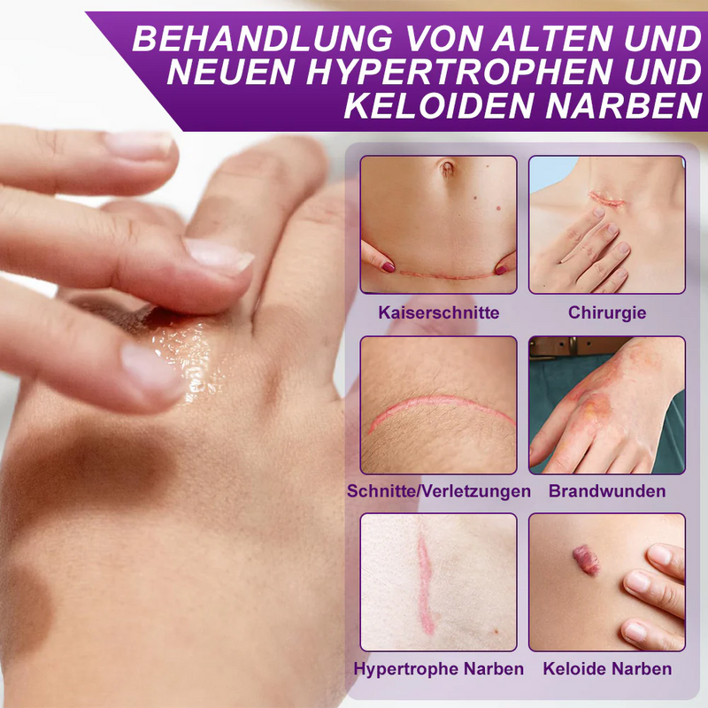 Flysmus Cure - Gel Para Cicatrizes