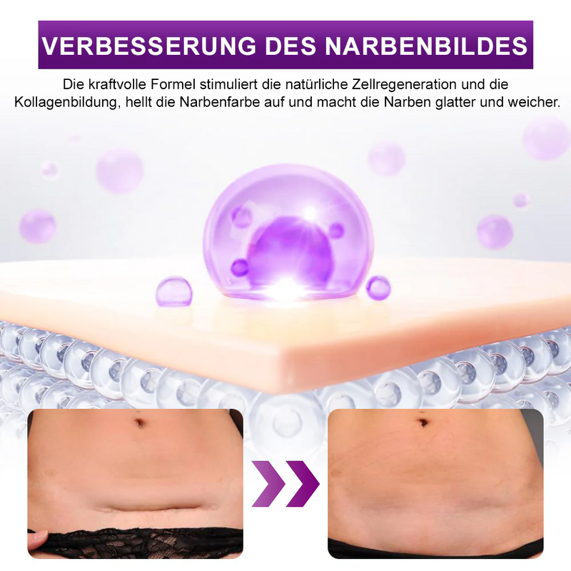 Flysmus Cure - Gel Para Cicatrizes