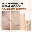 ClearFlaw - Solução para Cicatrizes