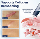 DermaFix - Removedor de Cicatrizes