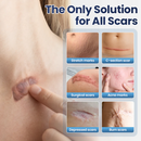 DermaFix - Removedor de Cicatrizes