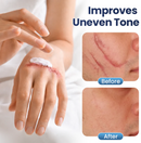 DermaFix - Removedor de Cicatrizes