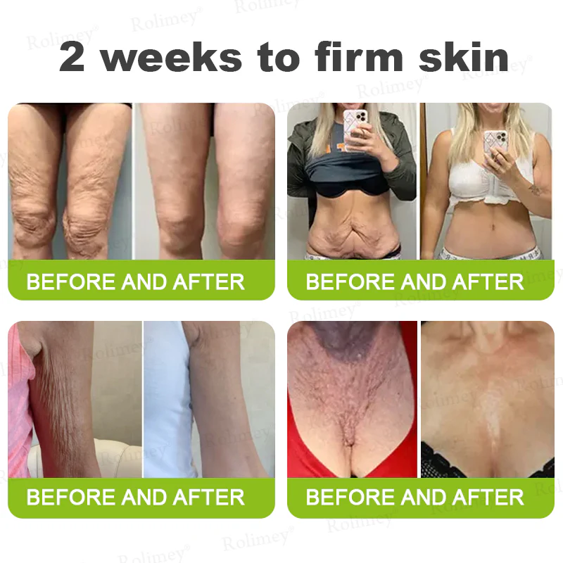 Sérum Shot De Botox