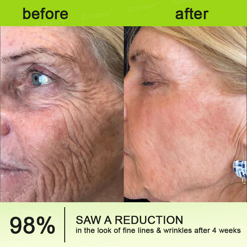 Sérum Shot De Botox