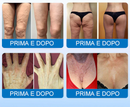 Fubsta® - Restaura a elasticidade da pele